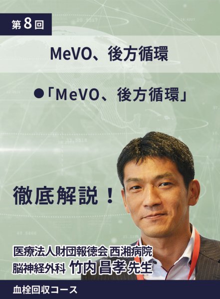 画像1: 動画≫≫≫ GSNET 血栓回収コース8️⃣ MeVO、後方循環 (1)