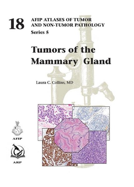 画像1: Tumors of the Mammary Gland（AFIP Atlas of Tumor & Non-Tumor Pathology, 5th Series,Fascicle 18） (1)