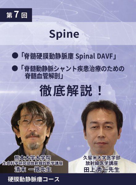 画像1: 動画≫≫≫ GSNET 硬膜動静脈瘻コース7️⃣「Spine」 (1)