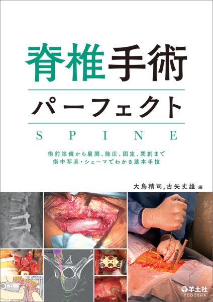 画像1: 脊椎手術パーフェクト (1)