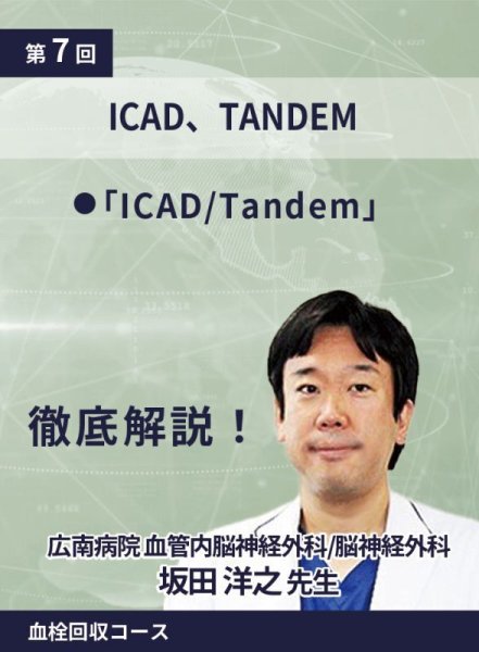画像1: 動画≫≫≫ GSNET 血栓回収コース7️⃣ 『ICAD、TANDEM』 (1)