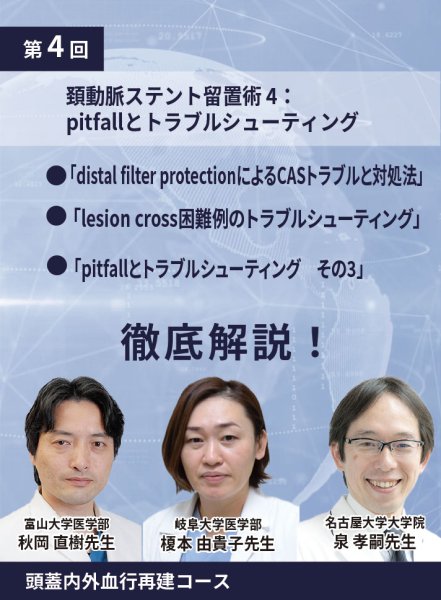 画像1: 動画≫≫≫ GSNET 頭蓋内外血行再建コース4️⃣「頚動脈ステント留置術 4：pitfallとトラブルシューティング」 (1)