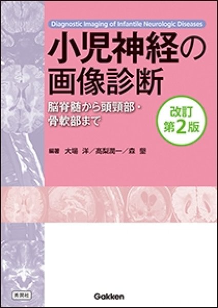 画像1: 小児神経の画像診断　改訂第２版  ―脳脊髄から頭頸部・骨軟部まで― (1)