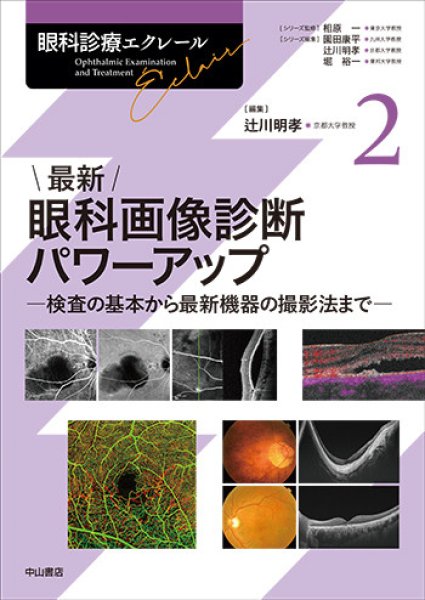 画像1: 最新 眼科画像診断パワーアップ－検査の基本から最新機器の撮影法まで（眼科診療エクレール 2） (1)