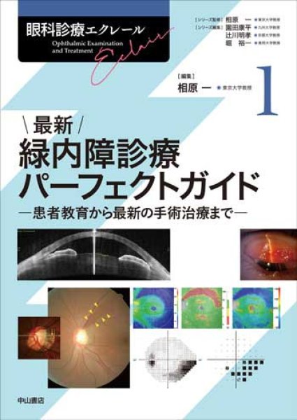 画像1: 最新 緑内障診療パーフェクトガイド－患者教育から最新の手術治療まで（眼科診療エクレール 1） (1)