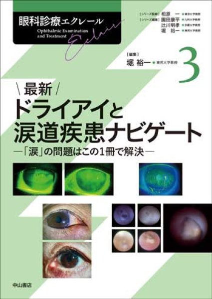 画像1: 最新 ドライアイと涙道疾患ナビゲート（眼科診療エクレール 3） (1)