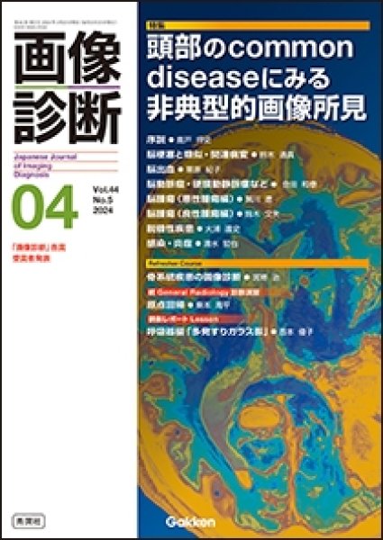 画像1: 【画像診断 2024年04月号】頭部のcommon diseaseにみる非典型的画像所見 (1)