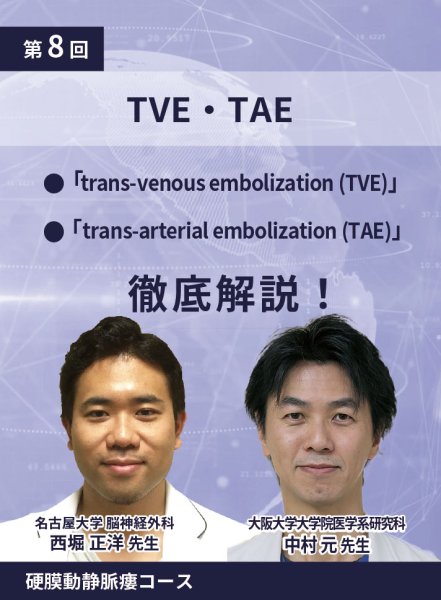 画像1: 動画≫≫≫ GSNET 硬膜動静脈瘻コース8️⃣「TVE・TAE」 (1)
