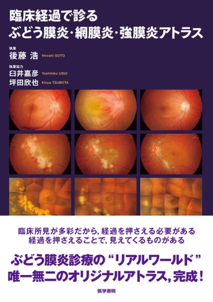 画像1: 臨床経過で診る ぶどう膜炎・網膜炎・強膜炎アトラス (1)