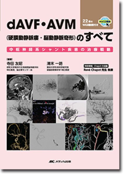 画像1: dAVF・AVM（硬膜動静脈瘻・脳動静脈奇形）のすべて (1)