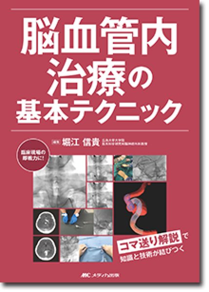 画像1: 《電子書籍.m3.com》脳血管内治療の基本テクニック (1)