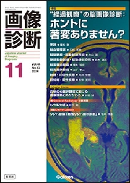 画像1: 【画像診断 2024年11月号】“経過観察”の脳画像診断：ホントに著変ありません？ (1)