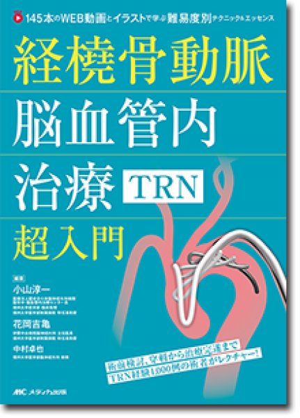 画像1: 《電子書籍.m3.com》経橈骨動脈脳血管内治療（TRN）超入門 (1)