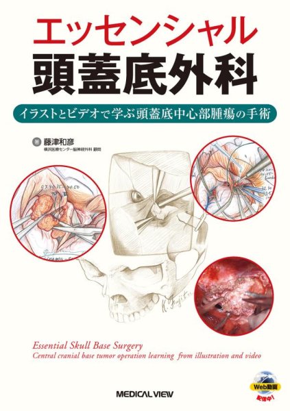 画像1: エッセンシャル頭蓋底外科 ［Web動画付］ イラストとビデオで学ぶ頭蓋底中心部腫瘍の手術 (1)