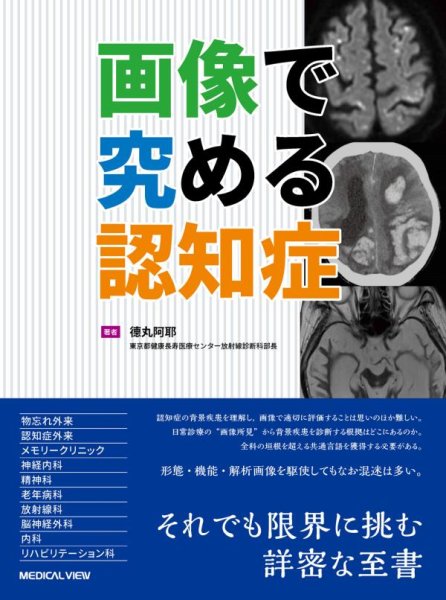画像1: 画像で究める認知症 (1)