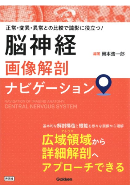 画像1: 《電子書籍.m3.com》脳神経画像解剖ナビゲーション 正常・変異・異常との比較で読影に役立つ！ (1)