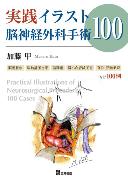 画像1: 《電子書籍.m3.com》実践イラスト脳神経外科手術100 (1)