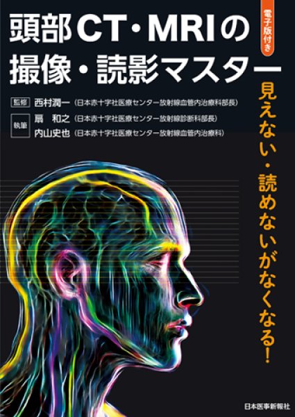 画像1: 頭部CT・MRIの撮像・読影マスター (1)