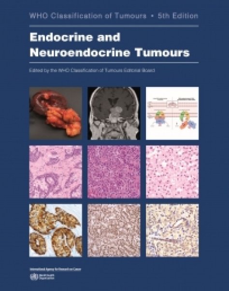 画像1: Endocrine and Neuroendocrine Tumours（WHO Classification of Tumours, 5th Edition, Volume 10） (1)