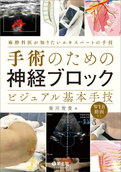 画像1: 手術のための神経ブロック　ビジュアル基本手技 麻酔科医が知りたいエキスパートの手技 (1)