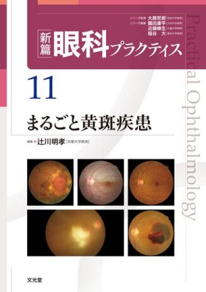 画像1: まるごと黄斑疾患（新編眼科プラクティスシリーズ 11） (1)