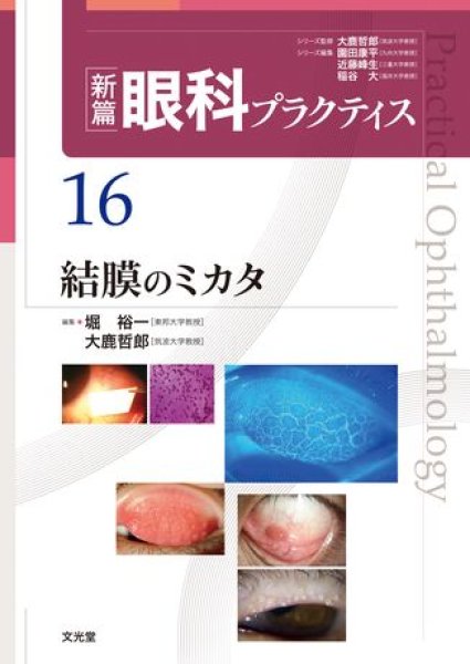 画像1: 結膜のミカタ（新編眼科プラクティスシリーズ 16） (1)