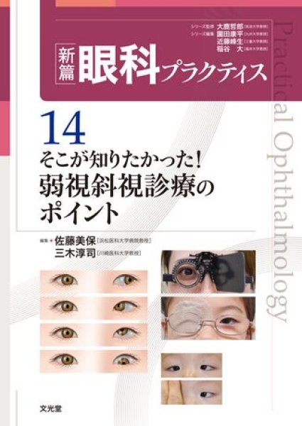 画像1: そこが知りたかった！弱視斜視診療のポイント（新編眼科プラクティスシリーズ 14） (1)