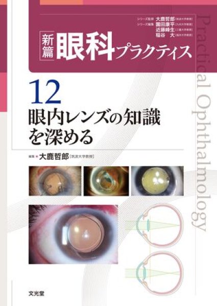 画像1: 眼内レンズの知識を深める（新編眼科プラクティスシリーズ 12） (1)