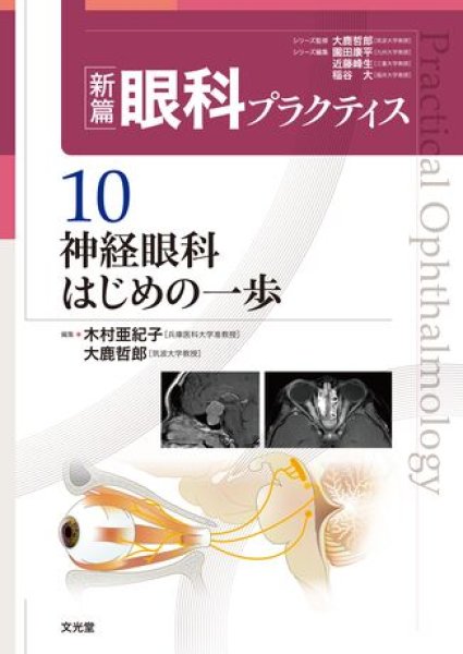画像1: 神経眼科はじめの一歩（新編眼科プラクティスシリーズ 10） (1)