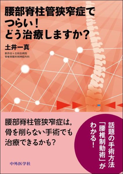 画像1: 腰部脊柱管狭窄症でつらい！どう治療しますか？ (1)