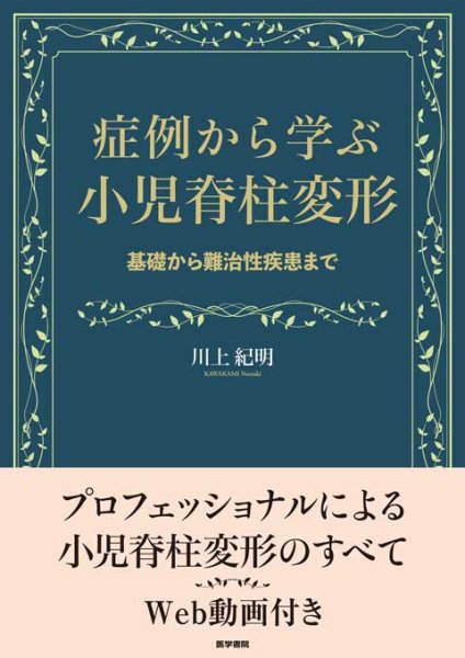 画像1: 症例から学ぶ小児脊柱変形 基礎から難治性疾患まで (1)