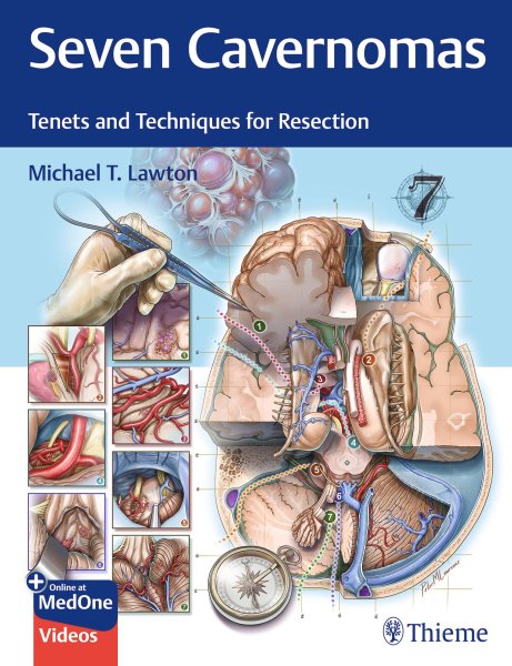 画像1: 《予約商品・2026年2月下旬入荷予定》Seven Cavernomas: Tenets & Techniques for Resection (1)