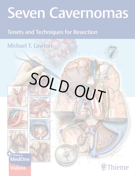 画像1: Seven Cavernomas: Tenets & Techniques for Resection (1)