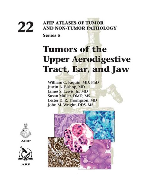 画像1: Tumors of the Upper Aerodigestive Tract, Ear, and Jaw (AFIP Atlas of Tumor & Non-Tumor Pathology, 5th Series,Fascicle 22) (1)