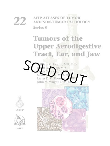 画像1: Tumors of the Upper Aerodigestive Tract, Ear, and Jaw (AFIP Atlas of Tumor & Non-Tumor Pathology, 5th Series,Fascicle 22) (1)
