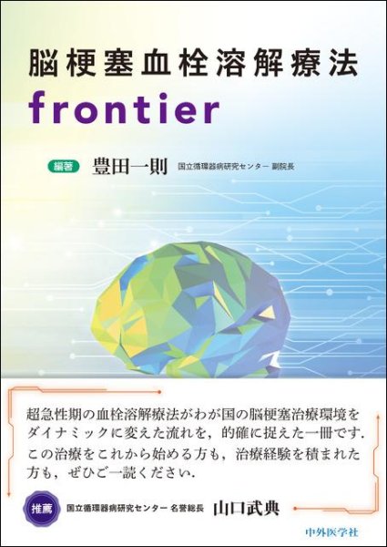 画像1: 脳梗塞血栓溶解療法frontier (1)