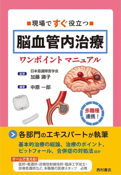 画像1: 現場ですぐ役立つ 脳血管内治療ワンポイントマニュアル (1)