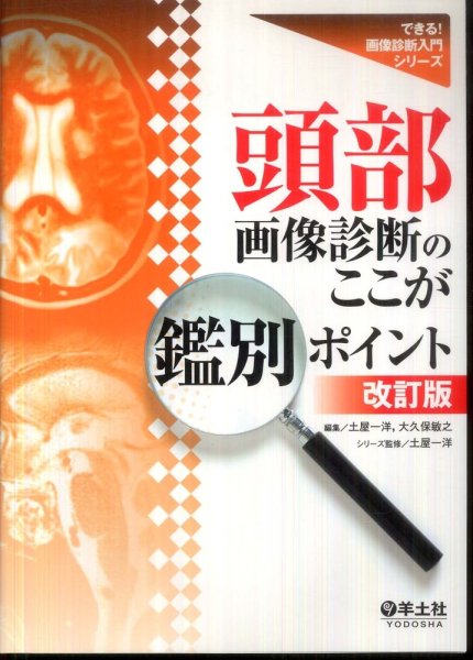 画像1: 頭部画像診断のここが鑑別ポイント（改訂版）《できる！画像診断入門シリーズ》 (1)