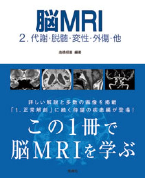 画像1: 脳MRI(2)　代謝・脱髄・変性・外傷・他 (1)