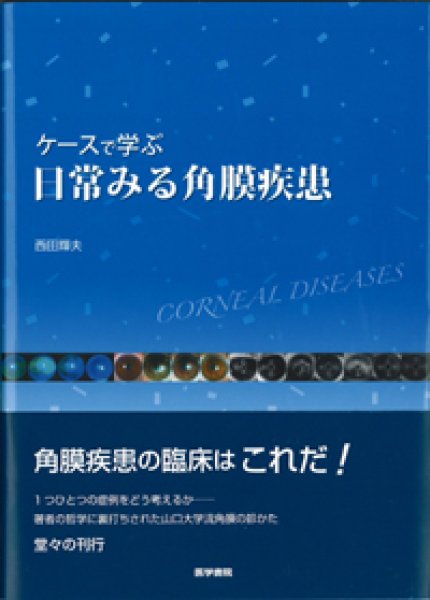 画像1: ケースで学ぶ 日常みる角膜疾患 (1)