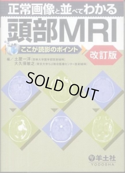 画像1: 正常画像と並べてわかる頭部MRI　ここが読影のポイント　改訂版 (1)