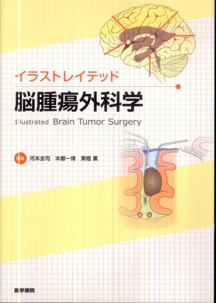 画像1: イラストレイテッド脳腫瘍外科学 (1)