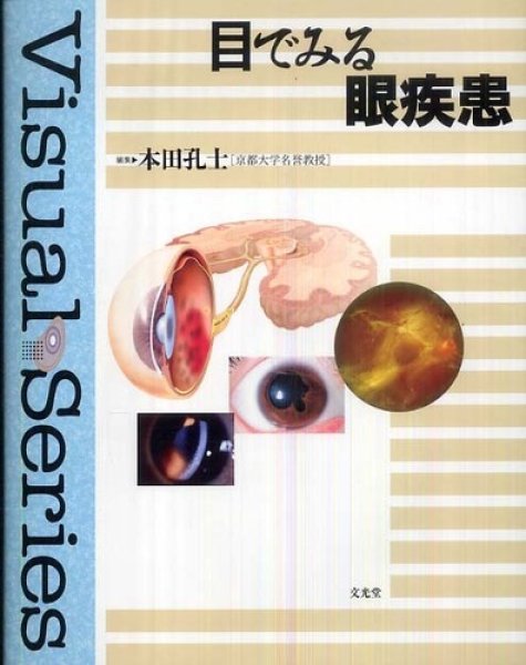 画像1: 目でみる眼疾患 (1)
