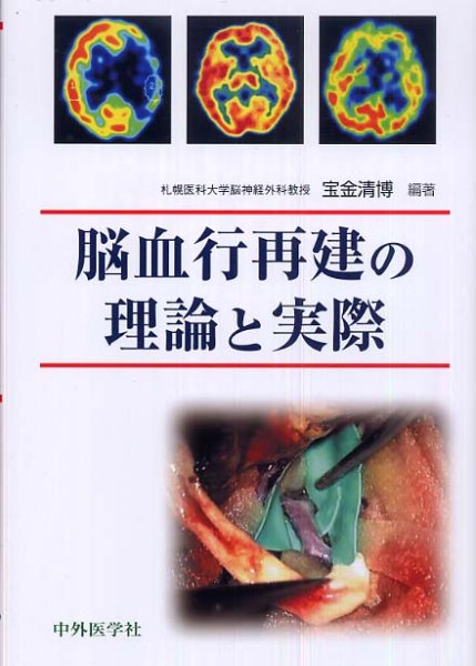 画像1: 脳血行再建の理論と実際 (1)