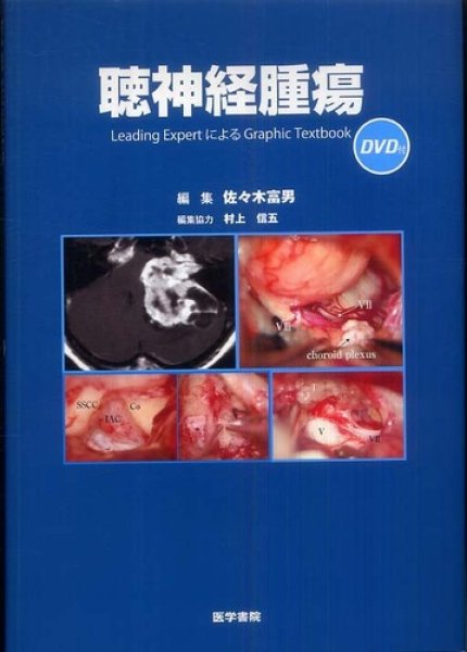 画像1: 聴神経腫瘍[DVD付]　Leading Expert による Graphic Textbook (1)