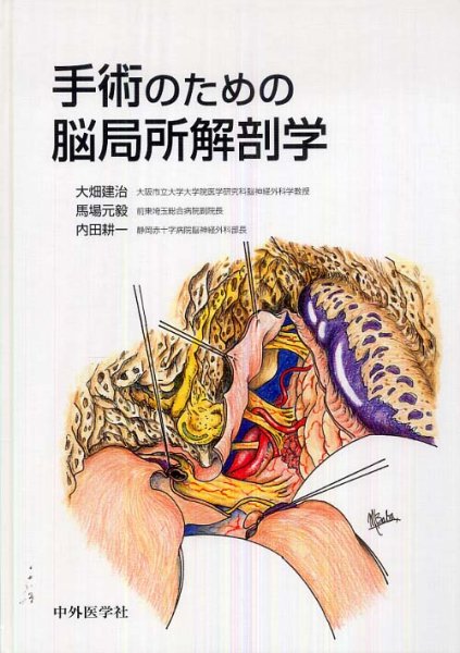 画像1: 手術のための脳局所解剖学 (1)