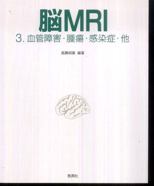 画像1: 脳MRI(3)　血管障害・腫瘍・感染症・他 (1)