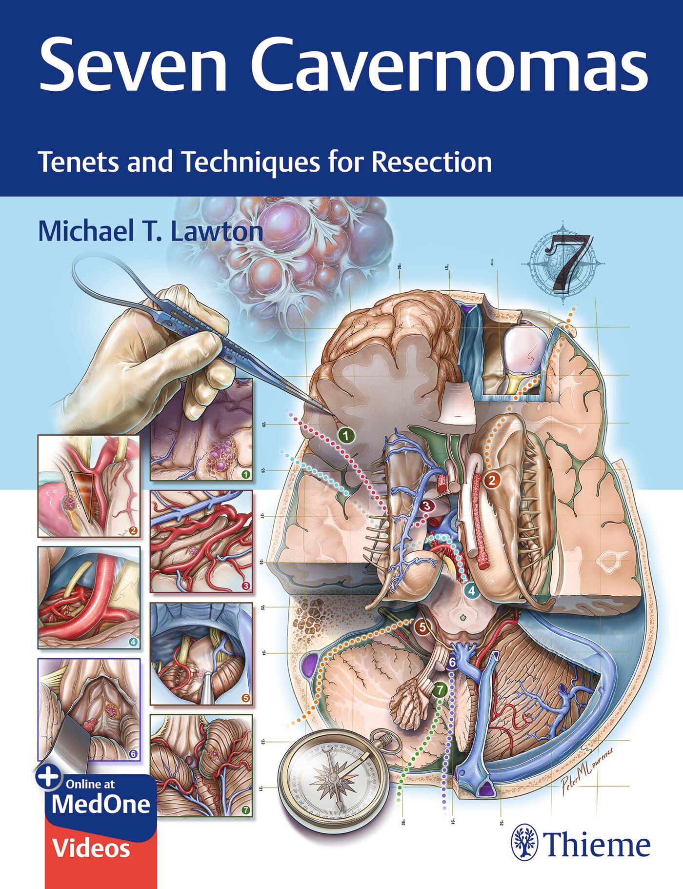 《近刊情報》 "Seven Cavernomas: Tenets & Techniques for Resection”