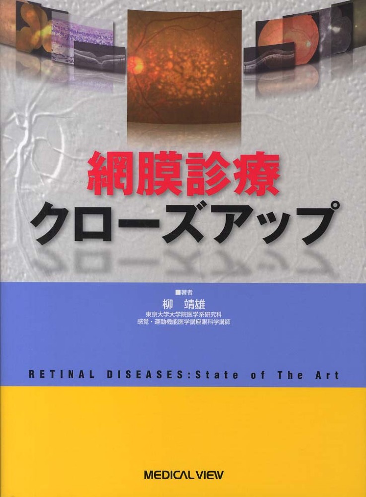 網膜診療クローズアップ　改訂第2版 [単行本] 柳 靖雄