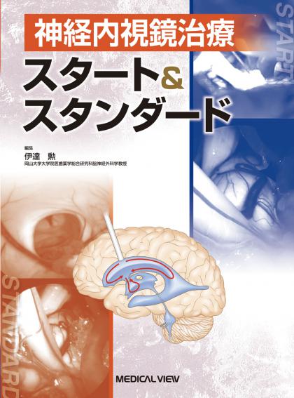 《電子書籍.m3.com》神経内視鏡治療　スタート＆スタンダード